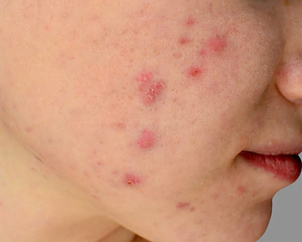 The Top 10 Most Common Skin Concerns
