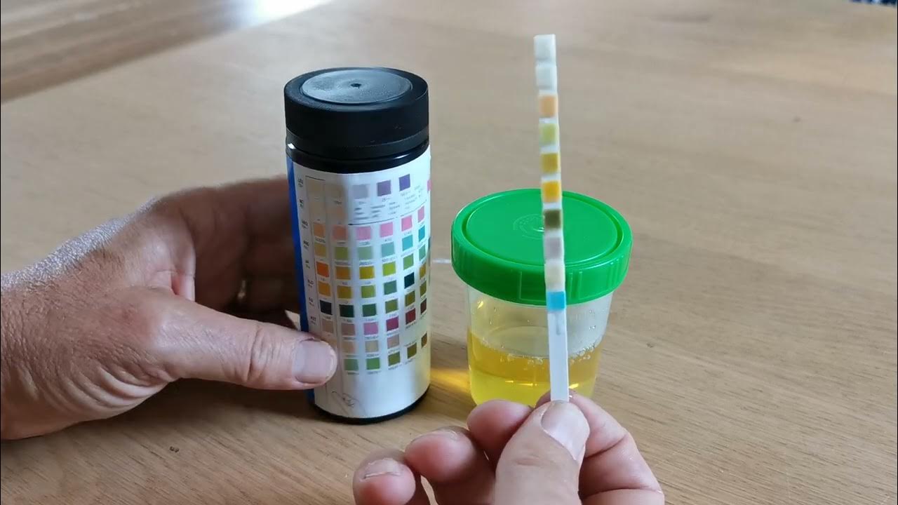 Pee Test Strips pgoto