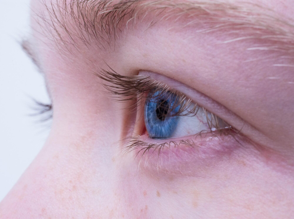 Hydrogel Cold Compress Benefits for Eye Strain and Swollen Eyelids
